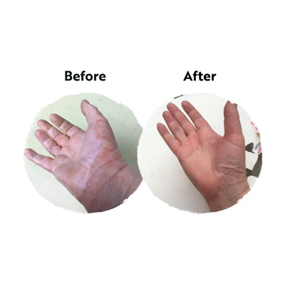 Before and after comparison of hands on a white background